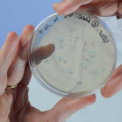 Expertise et analyse microbiologique